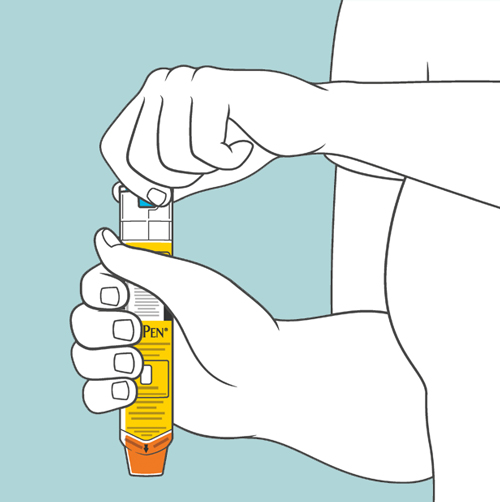 Tartu kiinni EpiPen